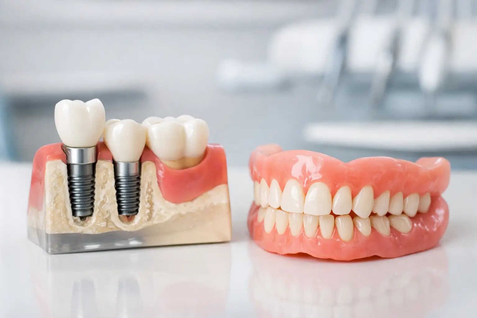 Dental Implants vs Dentures: What to Choose